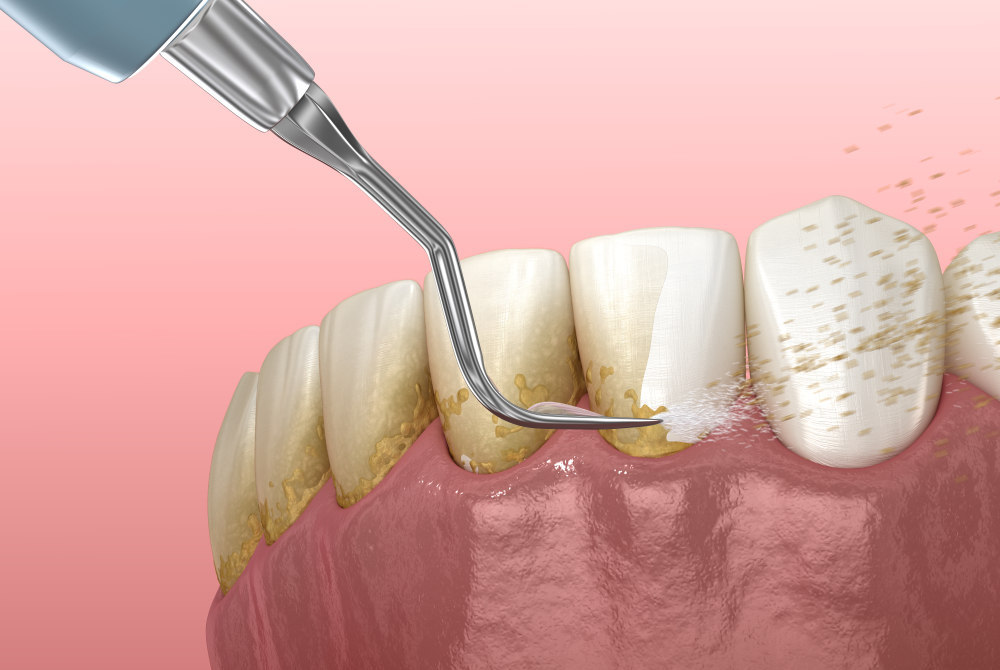 Pain-Free Scaling