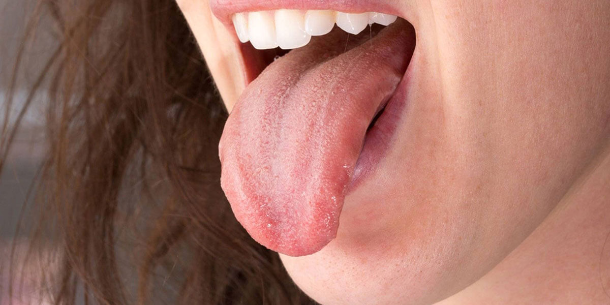Oral Carcinoma Management & Rehabilitation